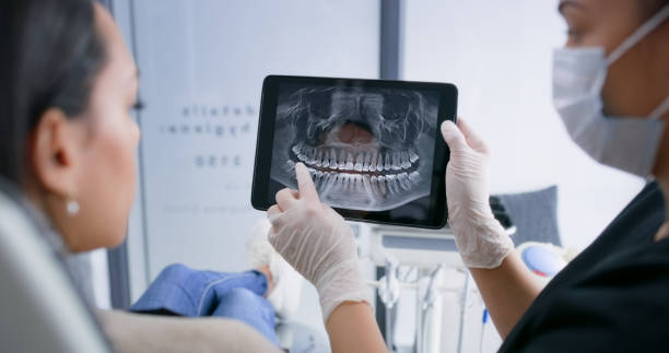 Licensed Dental Implants service in Stanford, CA - Smile Center Dentistry